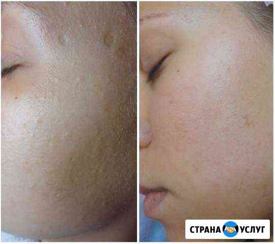 массаж в севастополе для мужчин частные объявления на дому. Смотреть фото массаж в севастополе для мужчин частные объявления на дому. Смотреть картинку массаж в севастополе для мужчин частные объявления на дому. Картинка про массаж в севастополе для мужчин частные объявления на дому. Фото массаж в севастополе для мужчин частные объявления на дому массаж в севастополе для мужчин частные объявления на дому. Смотреть фото массаж в севастополе для мужчин частные объявления на дому. Смотреть картинку массаж в севастополе для мужчин частные объявления на дому. Картинка про массаж в севастополе для мужчин частные объявления на дому. Фото массаж в севастополе для мужчин частные объявления на дому