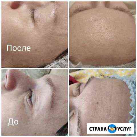 массаж на дому в ульяновске частные объявления для мужчин. Смотреть фото массаж на дому в ульяновске частные объявления для мужчин. Смотреть картинку массаж на дому в ульяновске частные объявления для мужчин. Картинка про массаж на дому в ульяновске частные объявления для мужчин. Фото массаж на дому в ульяновске частные объявления для мужчин массаж на дому в ульяновске частные объявления для мужчин. Смотреть фото массаж на дому в ульяновске частные объявления для мужчин. Смотреть картинку массаж на дому в ульяновске частные объявления для мужчин. Картинка про массаж на дому в ульяновске частные объявления для мужчин. Фото массаж на дому в ульяновске частные объявления для мужчин